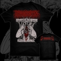 HYPERDONTIA - Aura Of Flies -- shirt.jpg