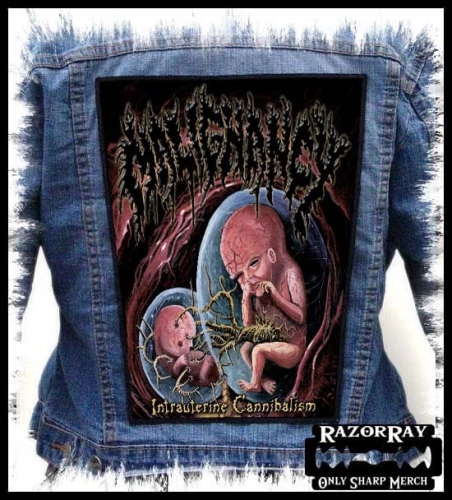 MALIGNANCY - Intrauterine Cannibalism -- backpatch back patch.jpg