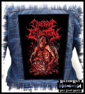 CEREBRAL INCUBATION -- Backpatch